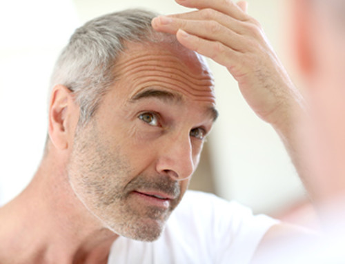 How Long Does It Take to See Results From Hair Restoration?